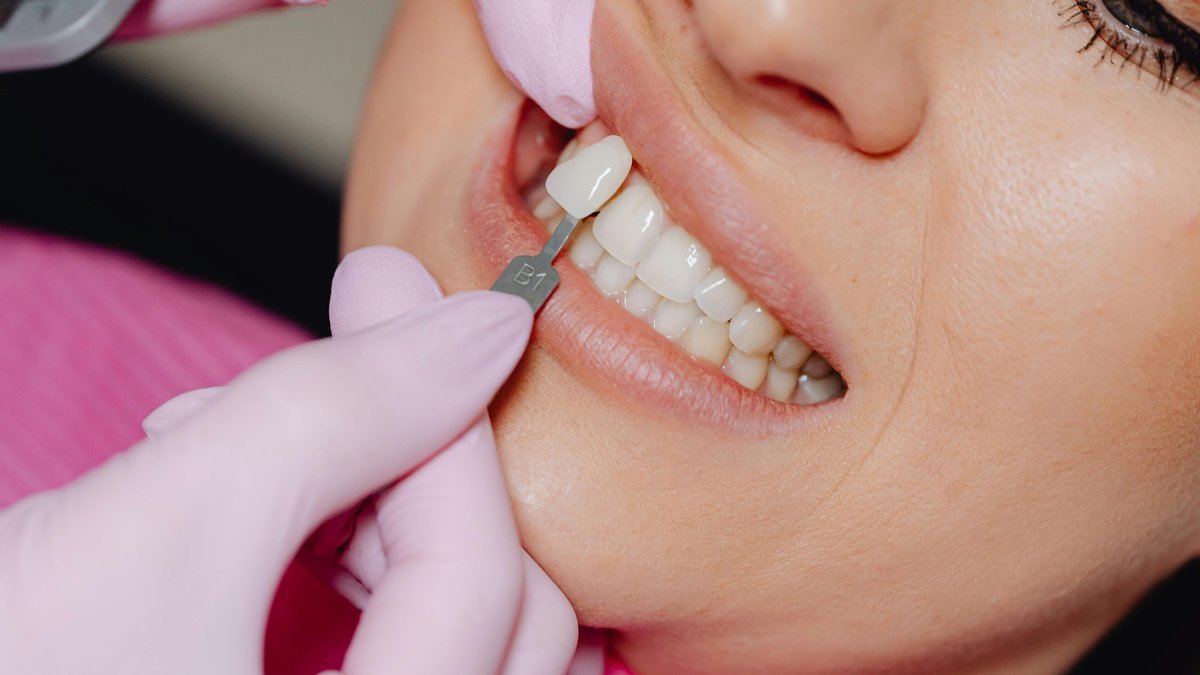 Dentist matching the right tooth shade during a professional whitening consultation